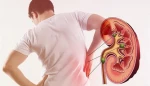 چطور از ابتلا به سنگ کلیه پیشگیری کنیم